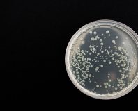 Próbka z bakteriami