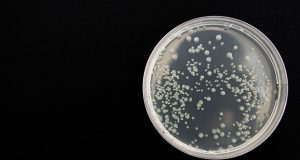 Próbka z bakteriami